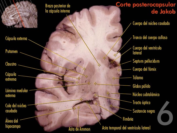 Cortes Cerebro Cortes Cerebro