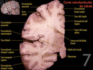 Circunvolución
                                     Corte retrolenticular
                    precentral                  de Jakob
                                                 Circunvolución
                    Surco                        frontal medial
                    central
                                                 Surco del cíngulo
                                                 Circunvolución del
Circunvolución
                                                 cíngulo
poscentral

Circunvolución                                   Tronco del cuerpo
supramarginal                                    calloso

Surco lateral                              Centro oval del lóbulo
                                           frontal

Circunvolución                          Lóbulo de la ínsula
temporal superior

Surco temporal                          Hipocampo
superior

Circunvolución
temporal media
 