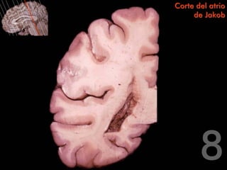 Corte del atrio
     de Jakob
 