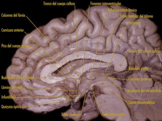 Tronco del cuerpo calloso      Foramen interventricular
                                                                         Adhesión intertalámica
Columna del fórnix                                                                 Estría medular del tálamo
                                                                                          Habénula
Comisura anterior


Pico del cuerpo calloso
                                                                                         Rodete del cuerpo calloso


                                                                                         Glándula pineal

Rodilla del cuerpo calloso                                                               Comisura posterior
Lámina terminal
                                                                                        Acueducto del mesencéfalo
Infundíbulo
                                                                                         Calota mesencefálica
Quiasma óptico
                                           Túber cinereum           Tubérculo mamilar
 