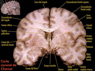 Surco del cíngulo                     Circunvolución frontal superior
                                                                                          Circunvolución
                                                                                          frontal media

                                                                                                  Surco
Circunvolución                                                                                    central
del cíngulo
Cuerpo calloso                                                                                    Cápsula
                                                                                                  interna
Septum
pellucidum
                                                                                                  Lámina
                                                                                                  medular
Cuerpo del                                                                                        externa
ventrículo lateral
                                                                                                  Putamen

                                                                                                  Globo
                                                                                                  pálido
                                                                                                  lateral
Corte
coronal de                                   Cuerpo mamilar             Globo         Lámina
Charcot              Cuerpo del fórnix                        Tálamo    pálido medial medular interna
 