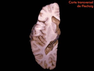 Corte transversal
     de Flechsig
 