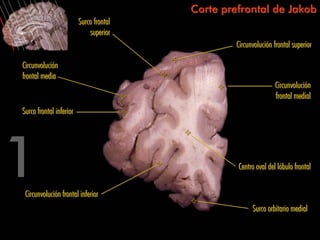 Corte prefrontal de Jakob
                         Surco frontal
                             superior
                                                  Circunvolución frontal superior

Circunvolución
frontal media
                                                                 Circunvolución
                                                                 frontal medial
Surco frontal inferior




                                                  Centro oval del lóbulo frontal


 Circunvolución frontal inferior
                                                        Surco orbitario medial
 