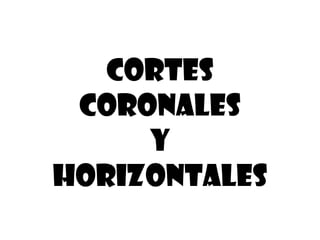 Cortes
 Coronales
     y
Horizontales
 