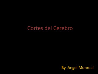 Cortes del Cerebro




             By. Angel Monreal
 
