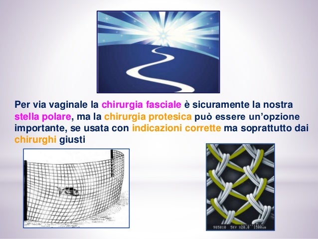 Prolasso Cupola prolasso di cupola lps vs Prolasso Cupola prolasso di cupola lps vs