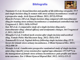 Bibliografia
- Naumann G et al, Sexual function and quality of life following retropubic TVT
and single-incision sling in women with stress urinary incontinence: results of
a prospective study. Arch Gynecol Obstet. 2013; 287(5):959-66
- Bianchi-Ferraro AM et al, Single-incision sling compared with transobturator
sling for treating stress urinary incontinence: a randomized controlled trial. Int
Urogynecol J. 2013; 24(9):1459-65
- Sun MJ et al, A comparative study of a single-incision sling and a
transobturator sling: clinical efficacy and urodynamic changes. Int Urogynecol
J. 2013; 24(5):823-9
- Minaglia S et al, Urethral mesh erosion after single-incision mid-urethral
sling. Female Pelvic Med Reconstr Surg. 2012; 18(5):310-2
- Tommaselli GA et al, Vaginal delivery following single incision sling (TVT-
Secur) for female stress urinary incontinence. J Obstet Gynaecol Res. 2013;
39(2):608-10
- Mostafa A et al, A multicentre prospective randomised study of single-incision
mini-sling (Ajust®) versus tension-free vaginal tape-obturator (TVT-O™) in
the management of female stress urinary incontinence: pain profile and short-
term outcomes. Eur J Obstet Gynecol Reprod Biol. 2012; 165(1):115-21
 