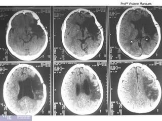 Profª Viviane Marques
 