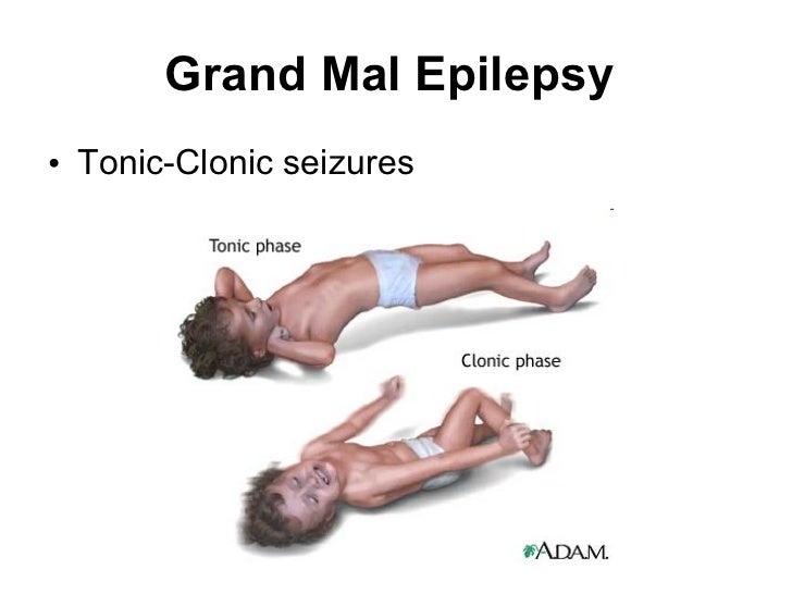 grand mal seizure cortex limbic etc grand mal seizure cortex limbic etc