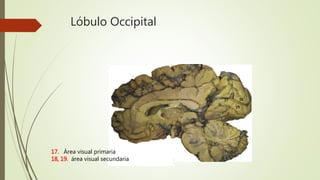 Lóbulo Occipital
Citoarquitecturadelacortezacerebr
La cara lateral del lóbulo occipital tiene menor
área de superficie, en comparación con su cara me-
dial, que es más extensa.
El área visual primaria o citoarquitectónica 17,
se ubica en las paredes de la cisura calcarina. Allí se
hace consciente la sensación de la visión y recibe afe-
rencias de la mitad temporal de la retina ipsi lateral y
de la mitad nasal de la retina contra lateral.
Lóbulo occipital
El área visual secundaria incluye varias áreas en
la región occipital y temporalo, en la región occipital
las áreas citoarquitectónicas 18 y 19 , ubicadas por
debajo y por encima de la cisura calcarina, reciben
aferencias de la 17 , y permite reconocer y apreciar lo
que se está viendo. Su lesión provoca alexia, es decir,
el paciente identifica claramente los grafemas pero
es incapaz de leer.
El área del gusto o citoarquitectónica 43 se ubica El lobo de la ínsula, ubicado en el fondo de la
17. Área visual primaria
18, 19. área visual secundaria
 
