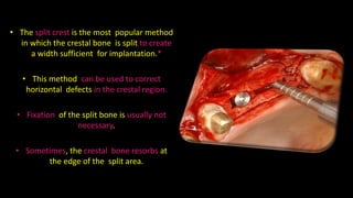 Cortical bone repositioning technique for horizontal alveolar bone augmentation : A case series