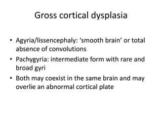 Gross cortical dysplasia
• Agyria/lissencephaly: ‘smooth brain’ or total
absence of convolutions
• Pachygyria: intermediat...