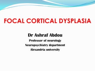 FOCAL CORTICAL DYSPLASIA
Dr Ashraf Abdou
Professor of neurology
Neuropsychiatry department
Alexandria university
 
