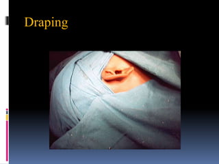 Draping
 