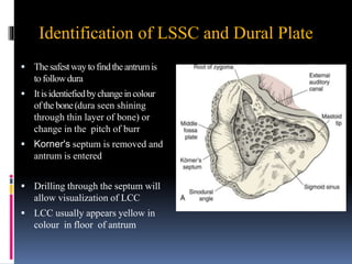 Identification of LSSC and Dural Plate
 Thesafestwaytofindtheantrumis
tofollowdura
 Itisidentiefiedbychangeincolour
ofthebone(dura seen shining
through thin layer of bone) or
change in the pitch of burr
 Korner's septum is removed and
antrum is entered
 Drilling through the septum will
allow visualization of LCC
 LCC usually appears yellow in
colour in floor of antrum
 