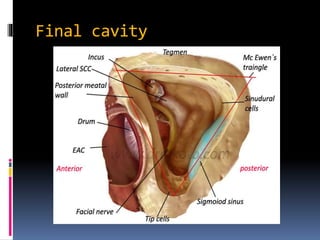 Final cavity
 