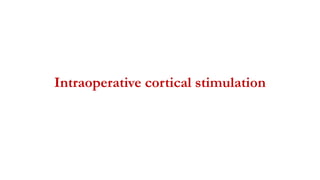 Intraoperative cortical stimulation
 