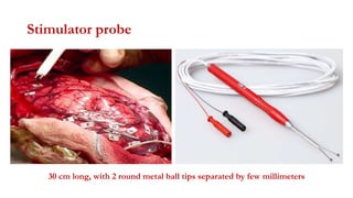 Stimulator probe
30 cm long, with 2 round metal ball tips separated by few millimeters
 