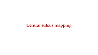 Central sulcus mapping
 