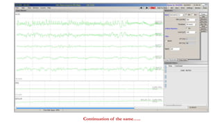 Continuation of the same…..
 