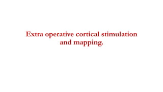 Extra operative cortical stimulation
and mapping.
 