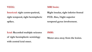 VEEG:
Interictal: right centro-parietal,
right temporal, right hemispheric
spikes.
Ictal: Recorded multiple seizures
of right hemispheric semiology
with central ictal onset.
MRI brain:
Right insular, right inferior frontal
FCD. Also, ?right superior
temporal gyrus involvement.
fMRI:
Motor area away from the lesion.
 