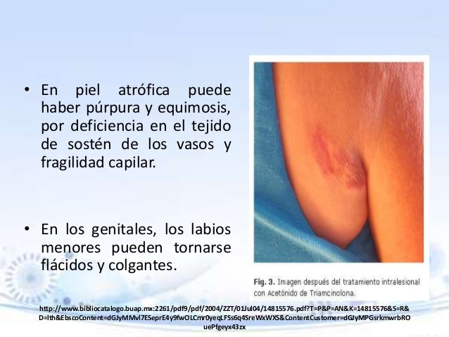 Roberto arenas atlas de dermatologia pdf
