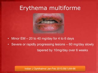 Erythema multiforme 
• Minor EM – 20 to 40 mg/day for 4 to 6 days 
• Severe or rapidly progressing lesions – 60 mg/day slowly 
tapered by 10mg/day over 6 weeks 
Indian J Ophthalmol Jan-Feb 2010;58(1):64-66 
 
