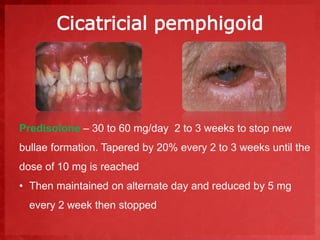 Cicatricial pemphigoid 
Predisolone – 30 to 60 mg/day 2 to 3 weeks to stop new 
bullae formation. Tapered by 20% every 2 to 3 weeks until the 
dose of 10 mg is reached 
• Then maintained on alternate day and reduced by 5 mg 
every 2 week then stopped 
 