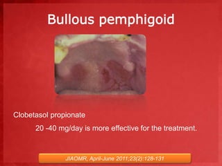 Bullous pemphigoid 
Clobetasol propionate 
20 -40 mg/day is more effective for the treatment. 
JIAOMR, April-June 2011;23(2):128-131 
 