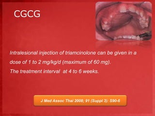 CGCG 
Intralesional injection of triamcinolone can be given in a 
dose of 1 to 2 mg/kg/d (maximum of 60 mg). 
The treatment interval at 4 to 6 weeks. 
J Med Assoc Thai 2008; 91 (Suppl 3): S90-6 
 