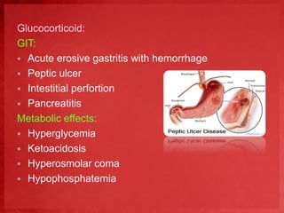 Glucocorticoid: 
GIT: 
 Acute erosive gastritis with hemorrhage 
 Peptic ulcer 
 Intestitial perfortion 
 Pancreatitis 
Metabolic effects: 
 Hyperglycemia 
 Ketoacidosis 
 Hyperosmolar coma 
 Hypophosphatemia 
 