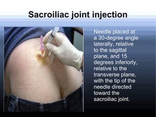 St Injection Corticosteroid injections in Orthopaedics | ODP