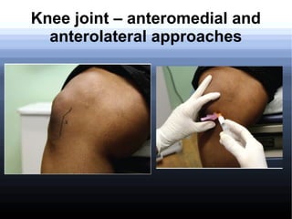 Corticosteroid injections in Orthopaedics | ODP