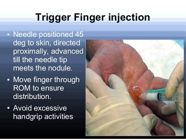 pain joint solution for in injections Corticosteroid Orthopaedics pain joint solution for in injections Corticosteroid Orthopaedics