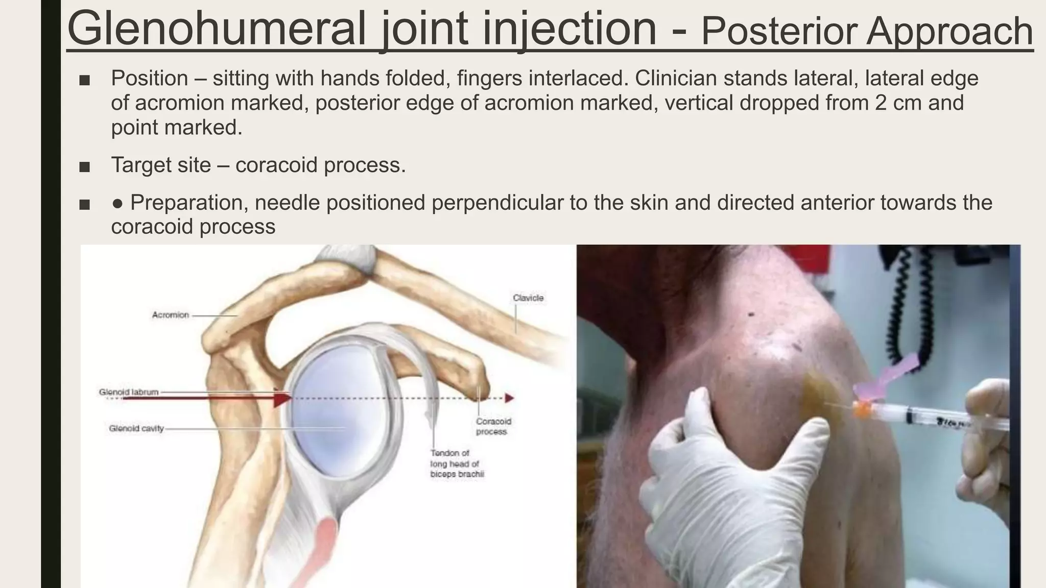 Corticosteroid injection techniques in orthopaedics | PPTX