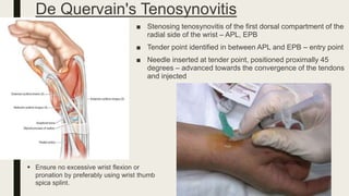 De Quervain's Tenosynovitis
■ Stenosing tenosynovitis of the first dorsal compartment of the
radial side of the wrist – APL, EPB
■ Tender point identified in between APL and EPB – entry point
■ Needle inserted at tender point, positioned proximally 45
degrees – advanced towards the convergence of the tendons
and injected
 Ensure no excessive wrist flexion or
pronation by preferably using wrist thumb
spica splint.
 