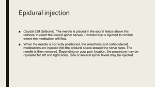 Epidural injection
■ Caudal ESI (tailbone). The needle is placed in the sacral hiatus above the
tailbone to reach the lowest spinal nerves. Contrast dye is injected to confirm
where the medication will flow.
■ When the needle is correctly positioned, the anesthetic and corticosteroid
medications are injected into the epidural space around the nerve roots. The
needle is then removed. Depending on your pain location, the procedure may be
repeated for left and right sides. One or several spinal levels may be injected
 