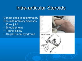 Intra-articular SteroidsIntra-articular Steroids
Can be used in inflammatory
Non-inflammatory diseases
• Knee joint
• Shoulder joint
• Tennis elbow
• Carpal tunnel syndrome
 