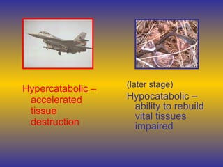 Hypercatabolic –
accelerated
tissue
destruction
(later stage)
Hypocatabolic –
ability to rebuild
vital tissues
impaired
 