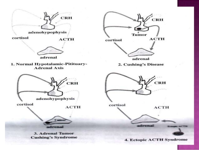 Cortisol assays & diagnostic laboratory procedures
