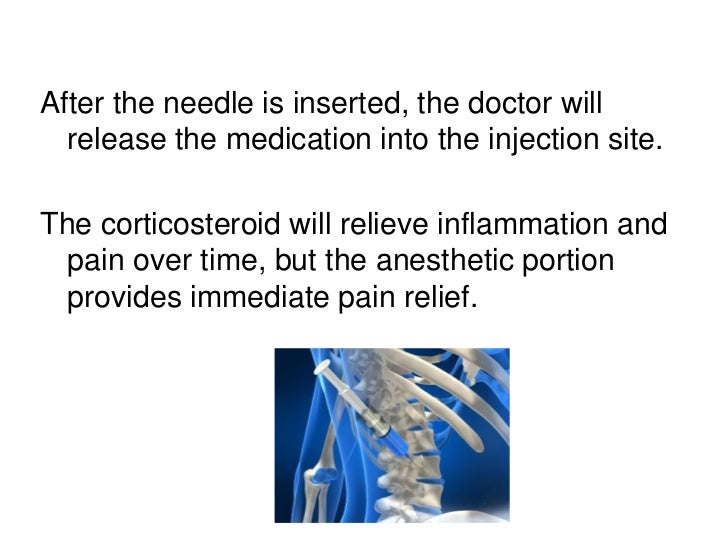 Cortisone Injections to Treat a Herniated Disc