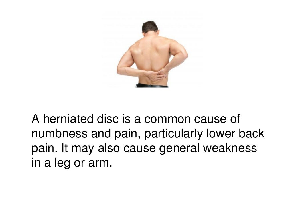 Cortisone Injections to Treat a Herniated Disc