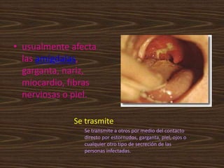 • usualmente afecta
  las amígdalas,
  garganta, nariz,
  miocardio, fibras
  nerviosas o piel.

             Se trasmite
                Se transmite a otros por medio del contacto
                directo por estornudos, garganta, piel, ojos o
                cualquier otro tipo de secreción de las
                personas infectadas.
 