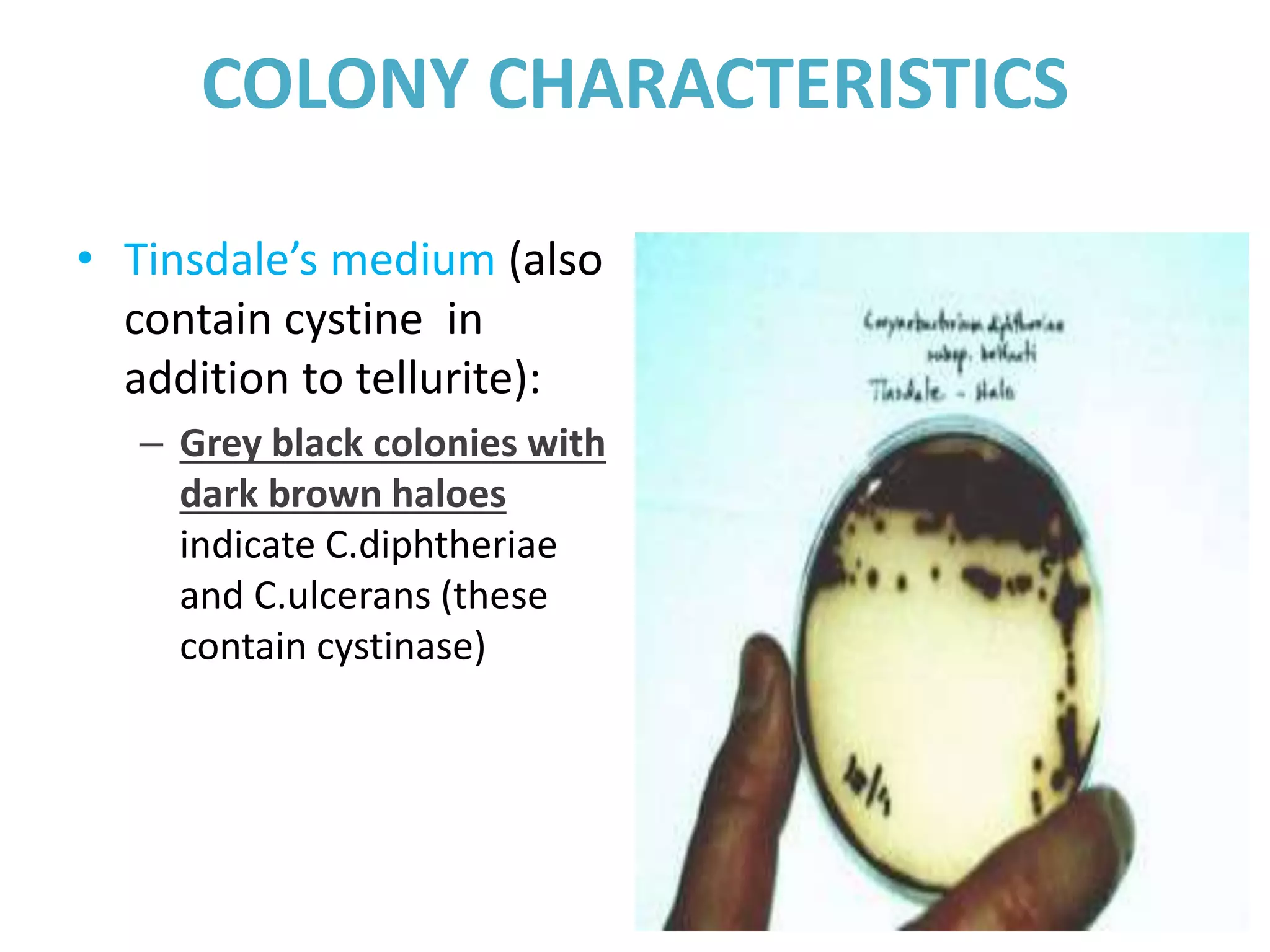COLONY CHARACTERISTICS
• Tinsdale’s medium (also
contain cystine in
addition to tellurite):
– Grey black colonies with
dark brown haloes
indicate C.diphtheriae
and C.ulcerans (these
contain cystinase)
 
