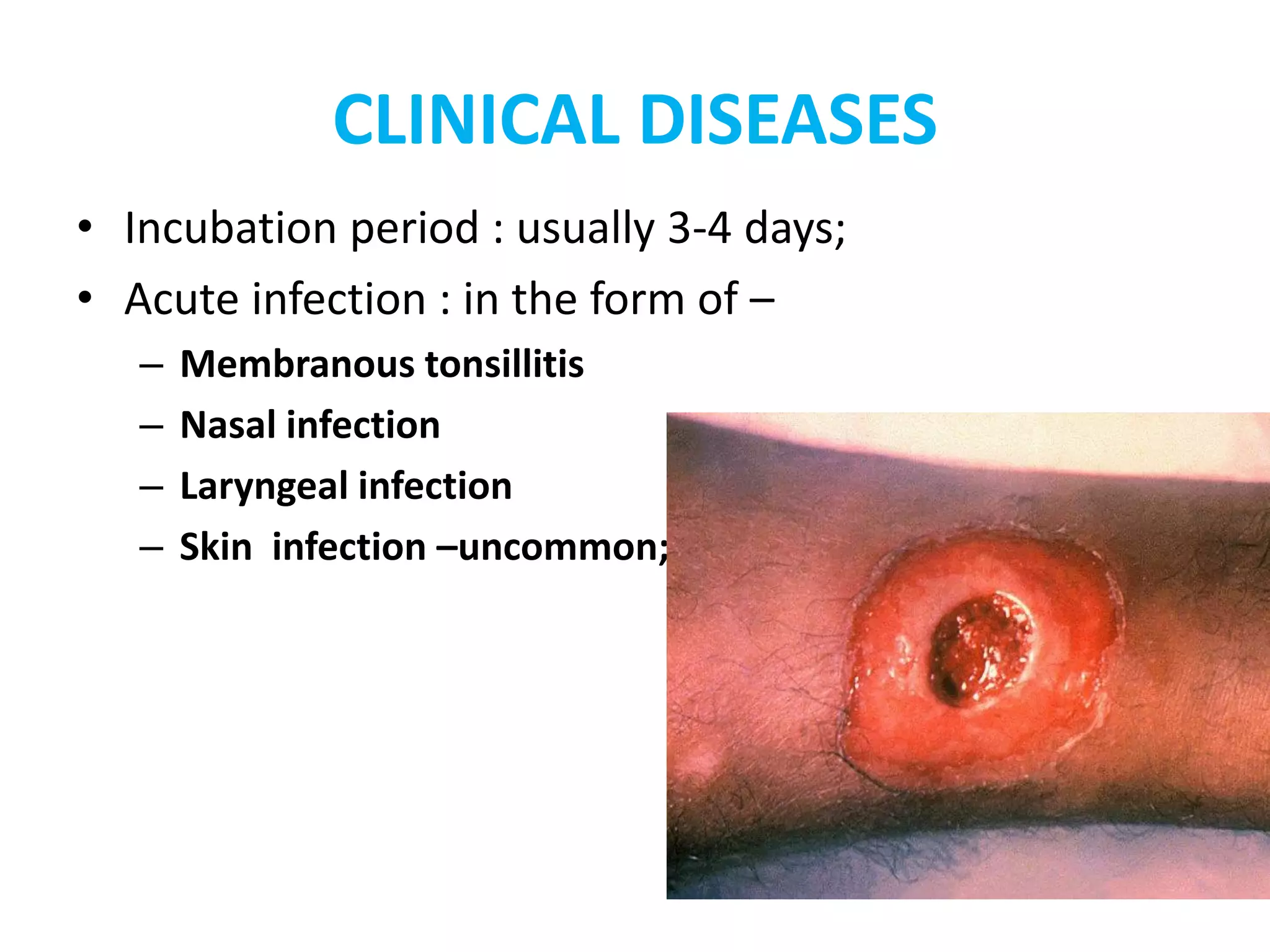 CLINICAL DISEASES
• Incubation period : usually 3-4 days;
• Acute infection : in the form of –
– Membranous tonsillitis
– Nasal infection
– Laryngeal infection
– Skin infection –uncommon;
 