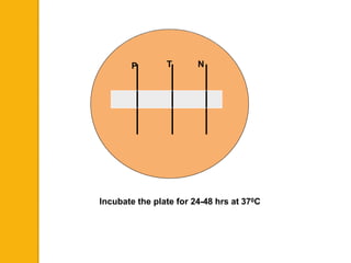 Incubate the plate for 24-48 hrs at 370C
TP N
 