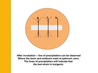 After incubation – line of precipitation can be observed
Where the toxin and antitoxin meet at optimum conc.
The lines of precipitation will indicate that
the test strain is toxigenic
P T N
 
