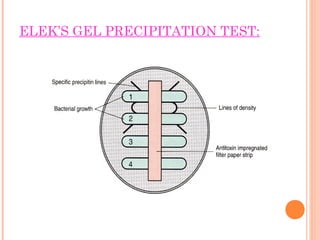 ELEK’S GEL PRECIPITATION TEST:
 