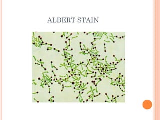 ALBERT STAIN
 